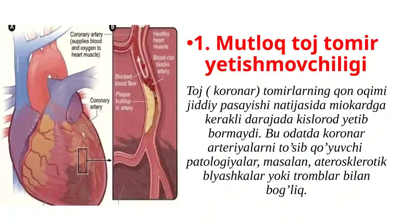 Mutloq vanisbiy toj tomir yetishmovchiligi. Yurak ishemik kasalligi, uning shakllari, sabablari va rivojlanish mexanizmlari 4