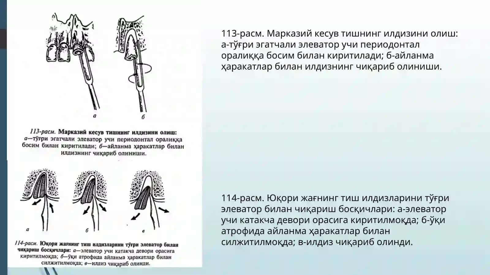 Tish ildizlarini bor mashina va elevatorlar yordamida olish texnikasi. 4