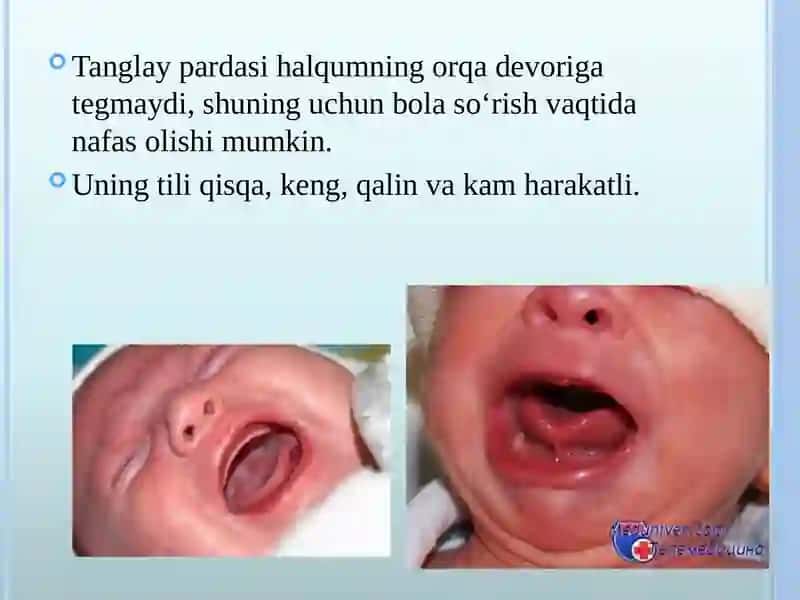 Bolalarda ovqat hazm qilish tizimining anatomik vafiziologik xususiyatlari 4