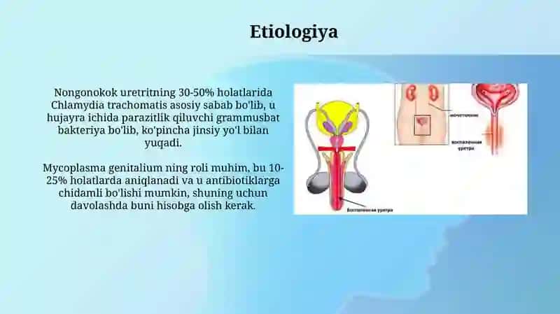 Nogonokokli uretritlar 4