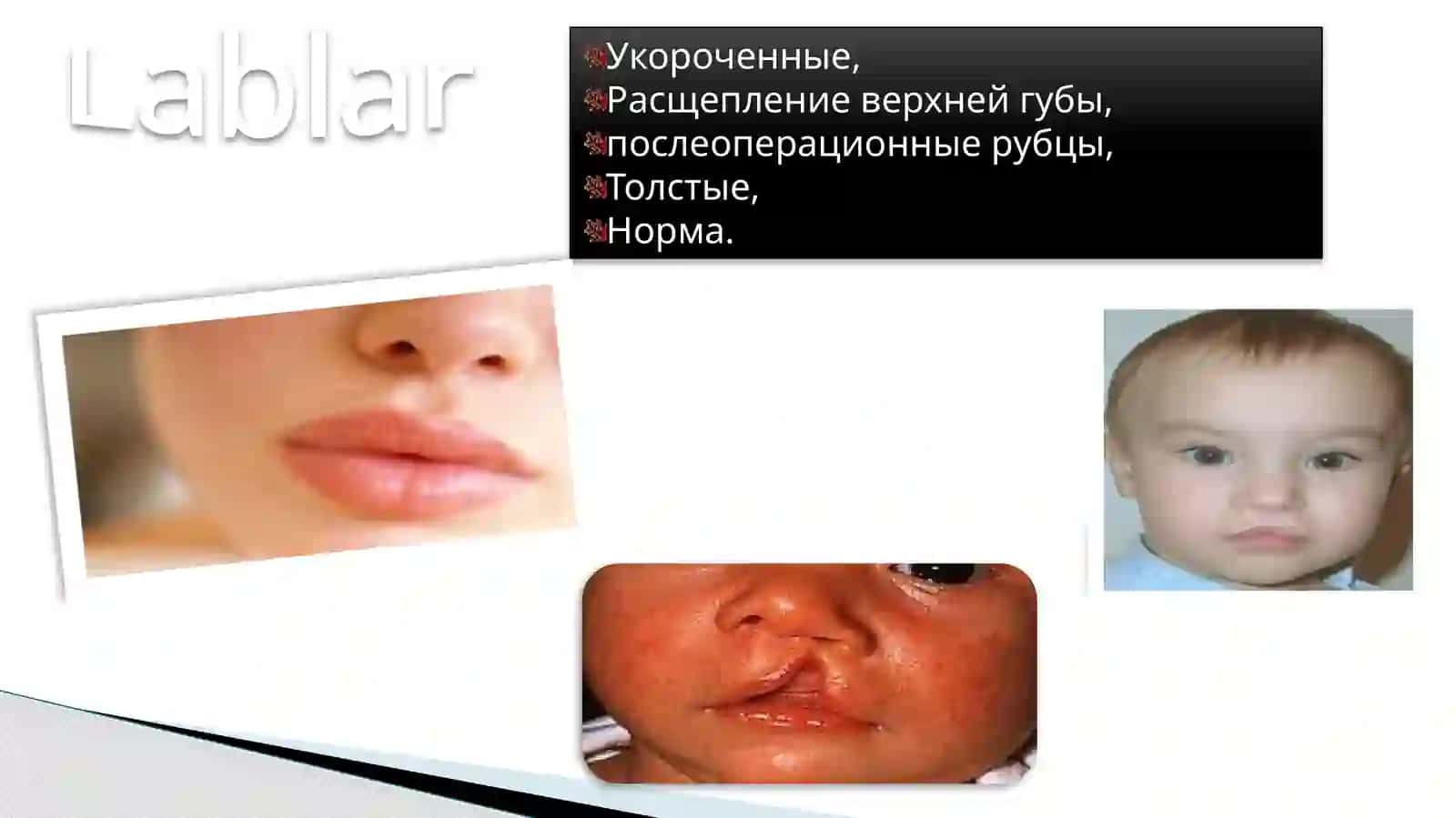 Товушларталаффузини логопедик текшириш 4