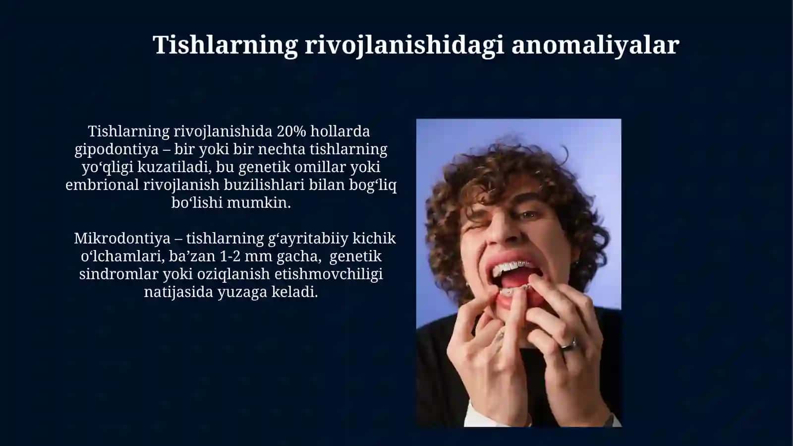 Jag'larning joylashishi bo'yicha anomaliyalar 4