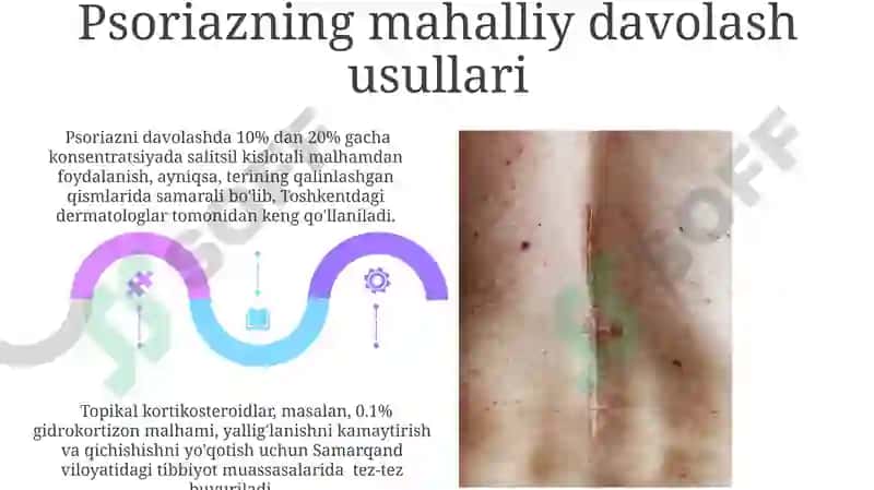 Profesional dermatozlar 5