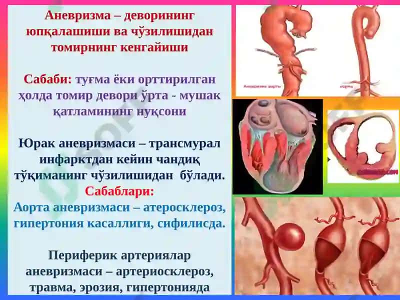 Қон томирлар патологияси. Томир аномалиялари. Гипертензия. Атеросклероз. Аневризмалар. Юрак патологияси Туғма юрак пороклари. ЮИК 5
