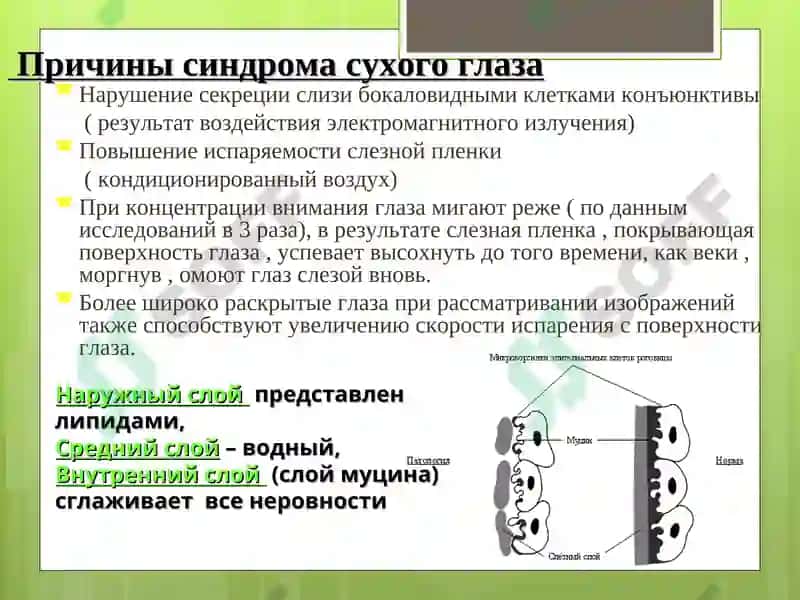 Синдром сухого глаза 5