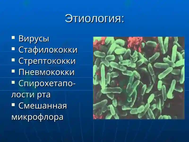 Острые и хронические заболевания среднего уха 5