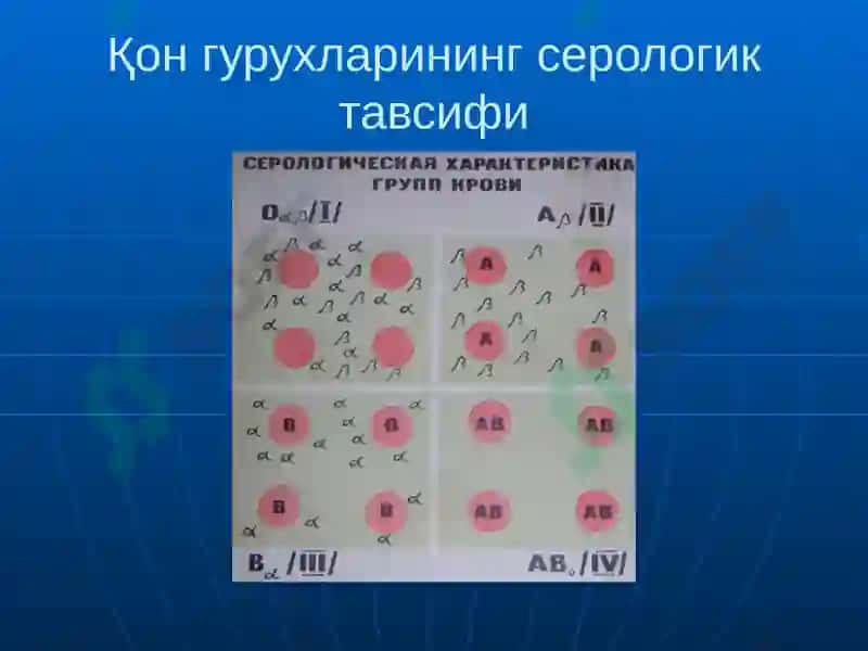Qon quyish asoslari 5