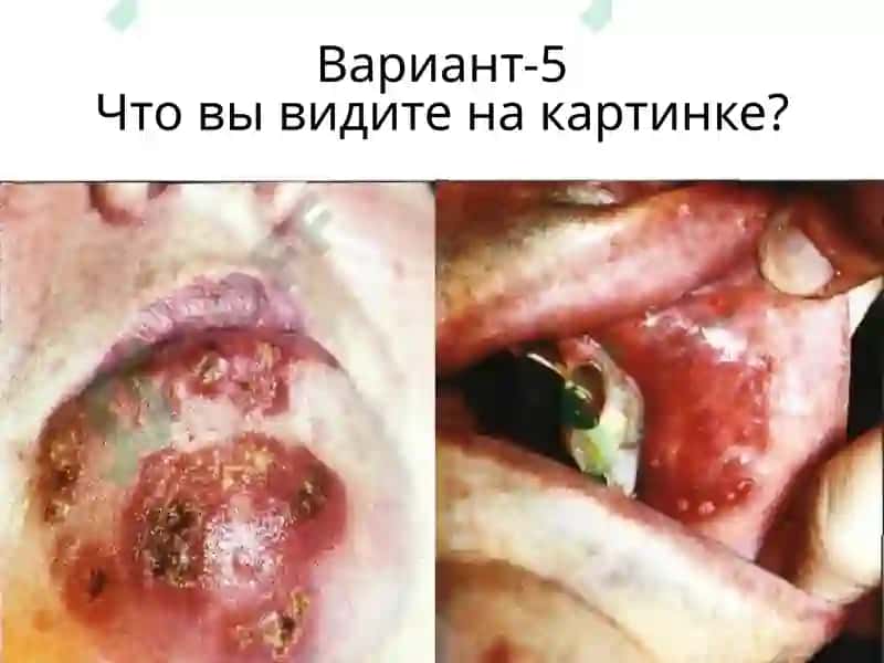 Вариант-1 5