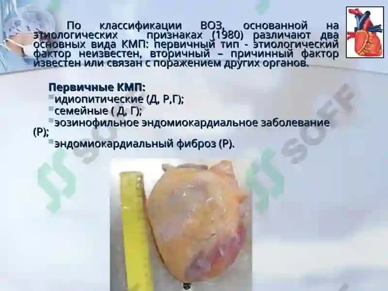 КАРДИОМИОПАТИИ 5
