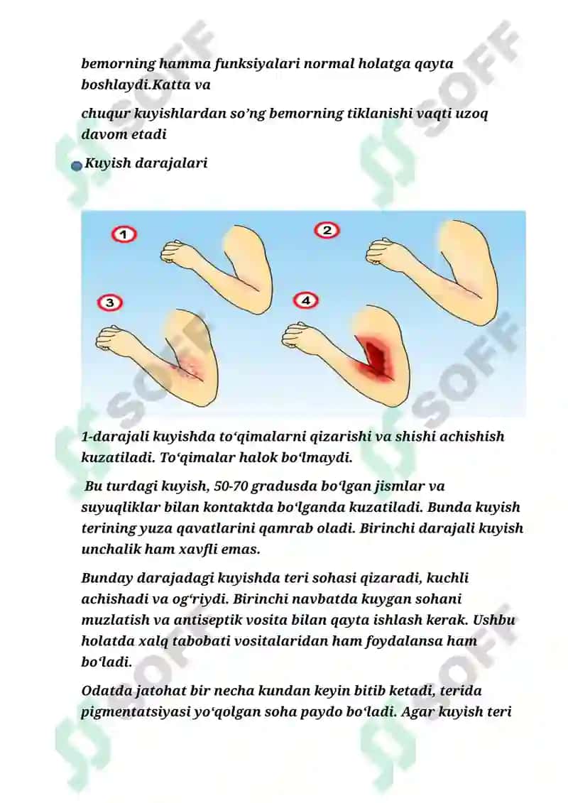 KUYISH KASALLIGI VA DARAJALARI.BEMORLARNING PARVARISHI 5