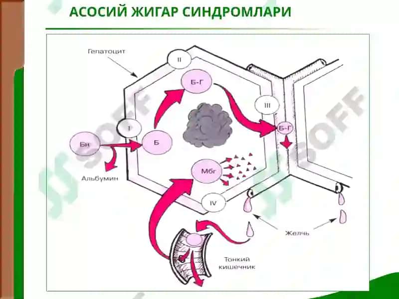 Жигар касалликларидаги асосий клиник синдромлар 5