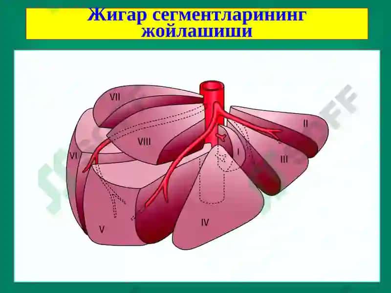 Жигар хирургик касалликлари 5