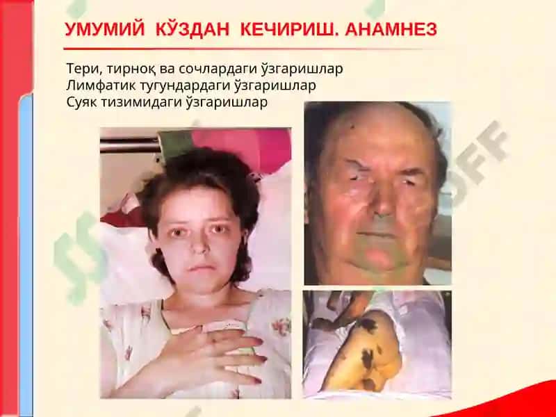 Перефферик кони таркиби 5