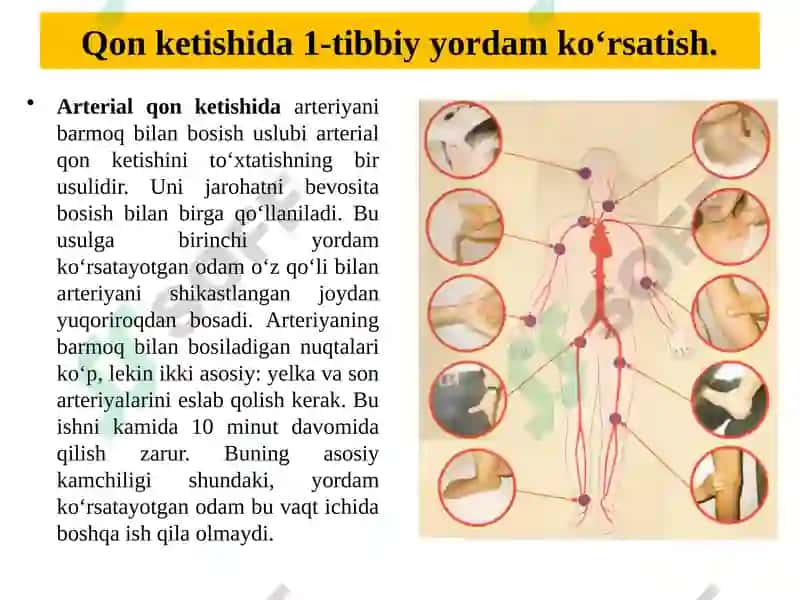 Qonketishida tibbiy yordam ko‘rsatish 5