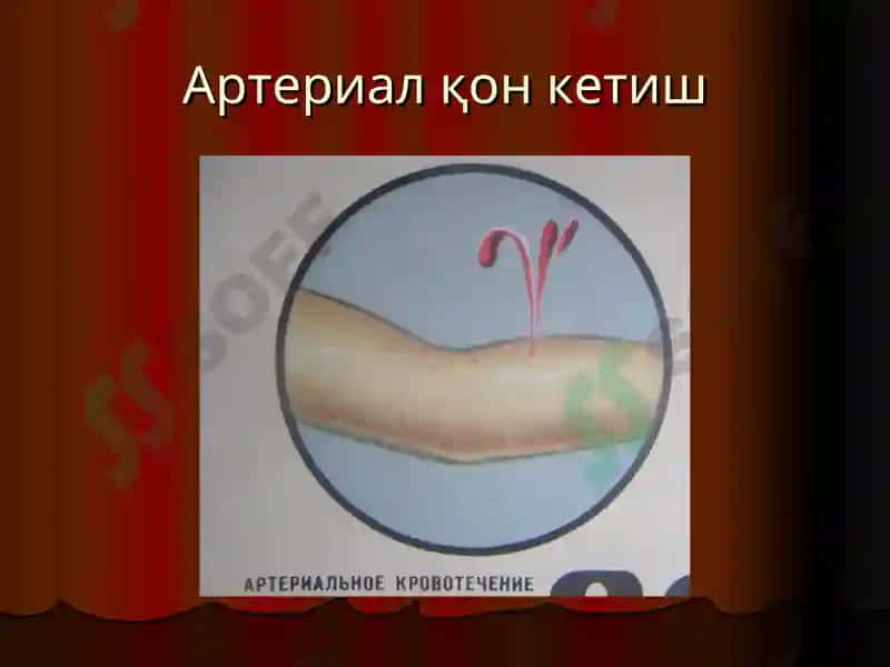 “Қон кетиш ва уни тўхтатиш усуллари” маъруза 5