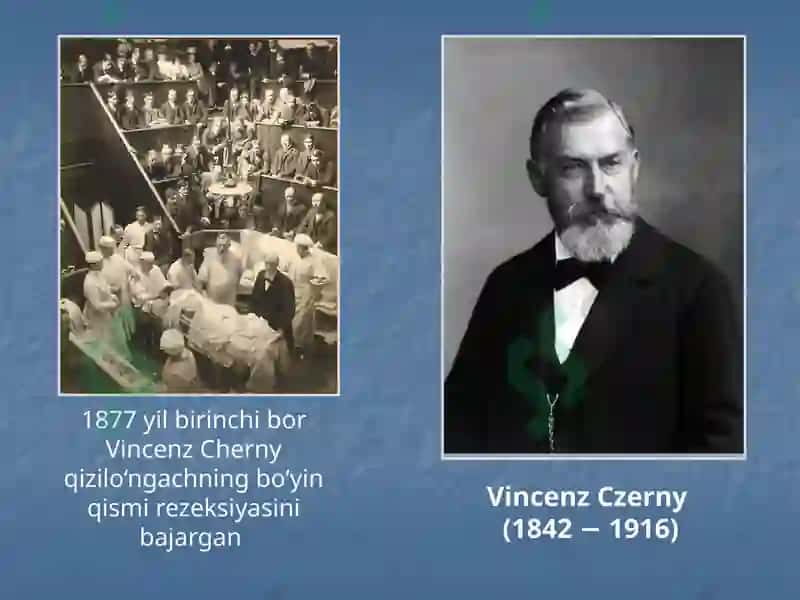 Bolalarda qizilo’ngach kuyishi va yot jismlari. Etiopatogenez, klinika, diagnostika va davolash usullari 5