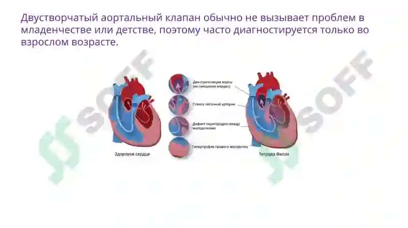 пороки сердца 5