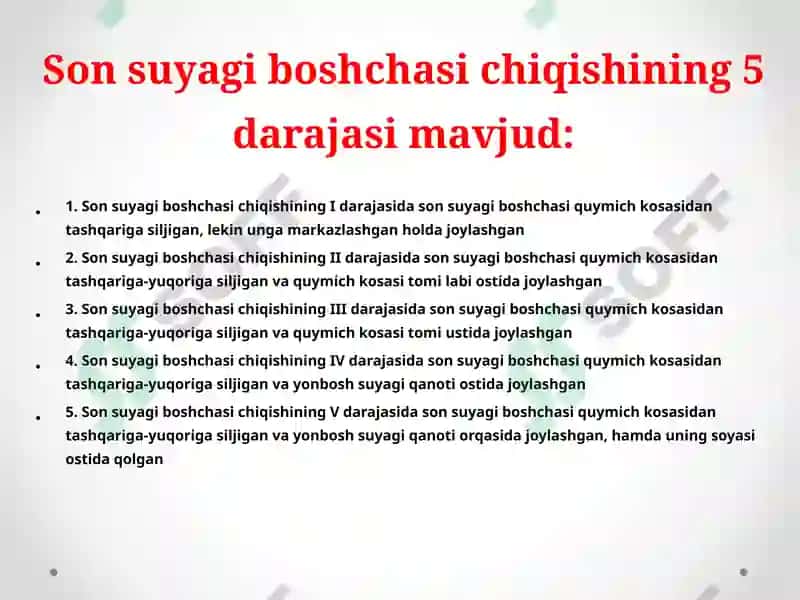 Son suyagi boshchasining tug'ma chiqishi, chanoq son bo'g'imi displaziyasi, tug'ma bo'yin qiyshiqligi, maymoqlilik, tug'ma maymoqoyoqlik. 5
