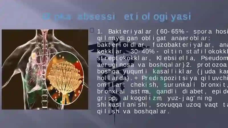 O’PKA ABSESSI VA GANGRENASI ETIOLOGIYASI 5