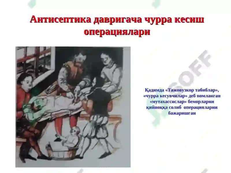 Қорин чурраларива унинг асоратлари 5