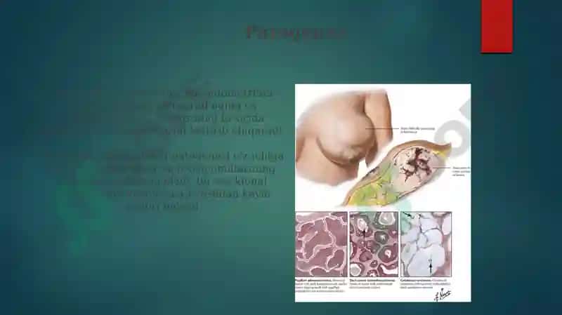 Ayollar jinsiy tizim a'zolari yallig'lanish jarayonini patofiziologiyasi 5