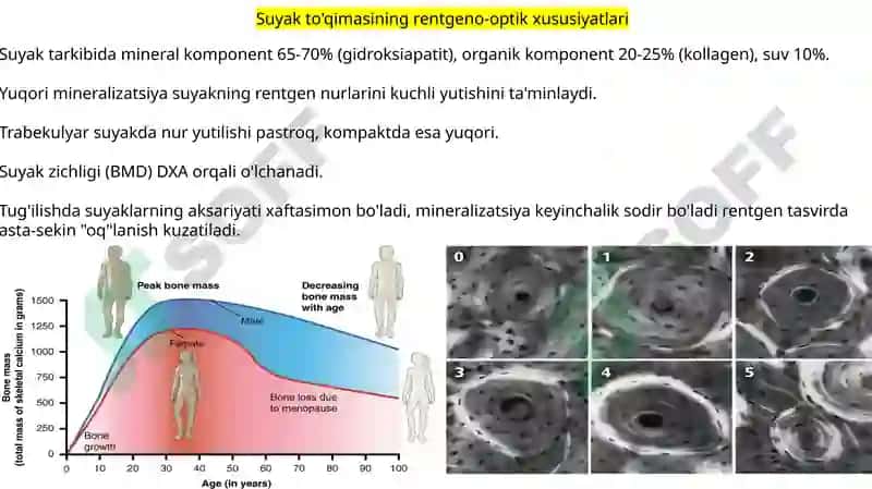 Rentgen_nurlarini_o'rganish_tarixi,_suyak_va_bo'g'imlar_rivojlanishini 5