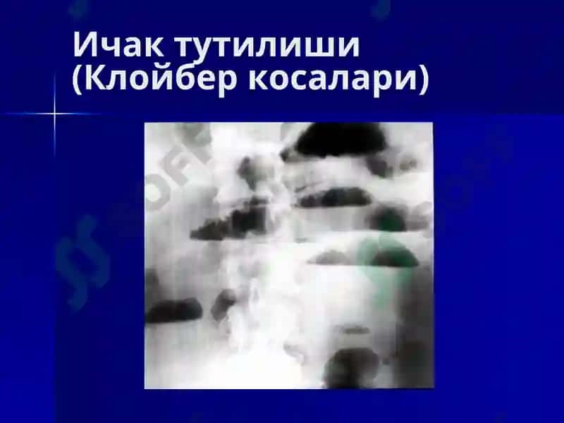 Ошқазон ичак касалликларида нур текшириш усуллари 5