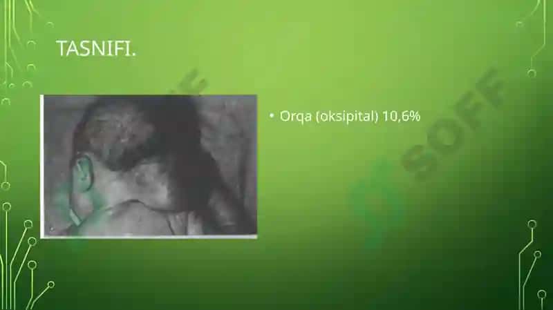 TUG'MA NUQSONLAR. BOLALARDA MIYA CHURRASI VA YURAK NUQSONLARI 5