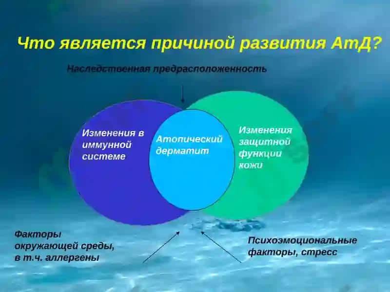 Atopik dermatit 6
