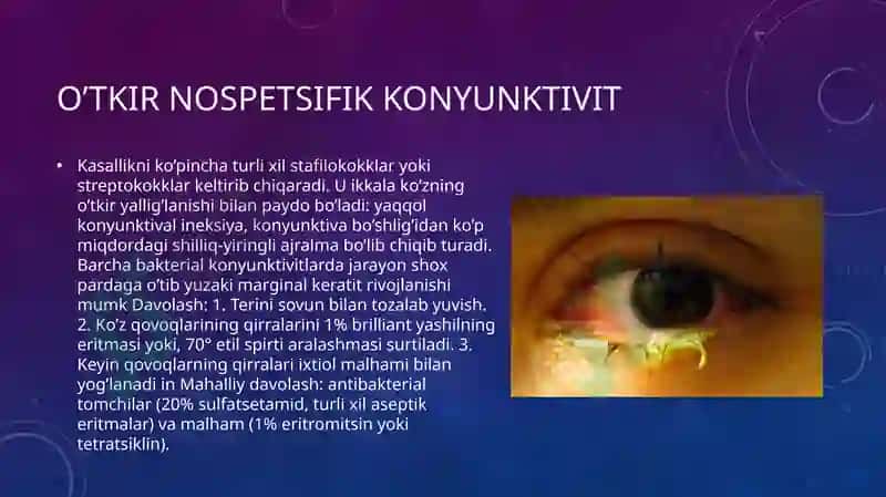 Kon’yunktivitlarnibirdanepidemikavjolishinioldiniolishbo`yichaprofilaktikchoratadbirlar 6