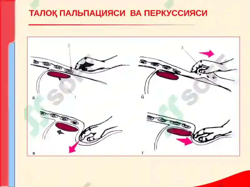 КОН ТИЗИМИ КАСАЛЛИКЛАРИ БИЛАН КАСАЛЛАНГАН БЕМОРЛАРНИ ТЕКШИРИШ. АСОСИЙ КЛИНИК СИМПТОМЛАР 6