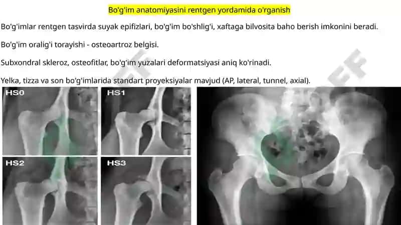 Rentgen_nurlarini_o'rganish_tarixi,_suyak_va_bo'g'imlar_rivojlanishini 6