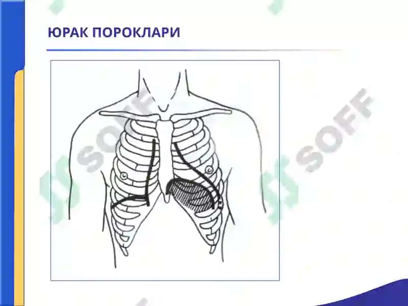 ЮРАК ПОРОКЛАРИ. АОРТА КЛАПАНИНИНГ ЕТИШМОВЧИЛИГИ. 
АОРТА ОҒЗИНИНГ СТЕНОЗИ. 
ҚОН АЙЛАНИШИ ЕТИШМОВЧИЛ 6