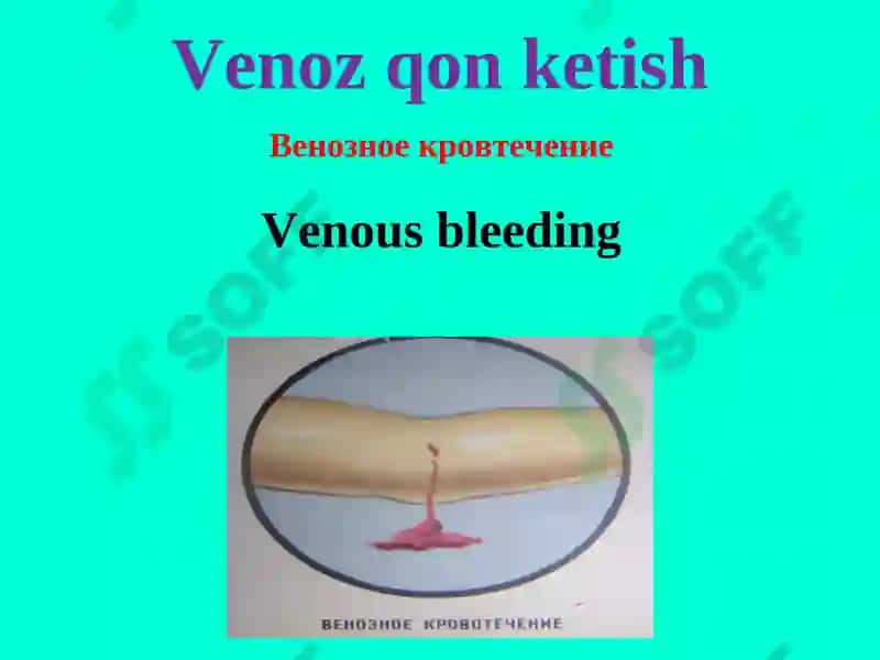 Qon ketish va uni to‘xtatish usullari 6