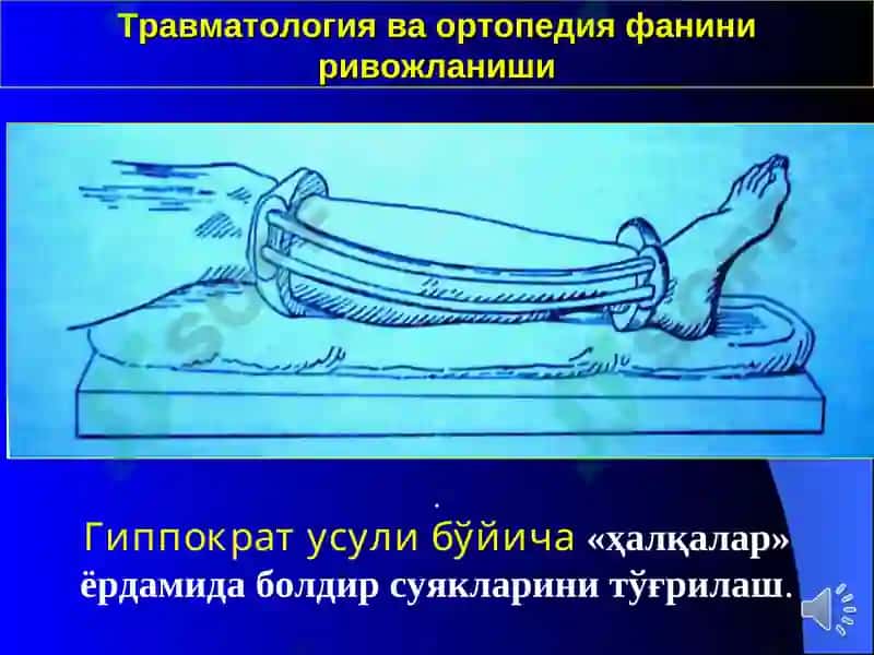 Травматология ва ортопедия 6