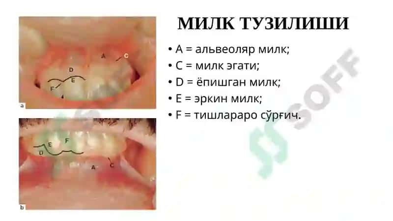 Пародонтонтология 6