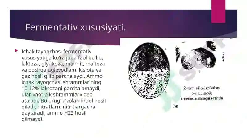 Ichak infeksiyalari qo`zg`atuvchilari: Esherixioz qo`zg`atuvchisi 6