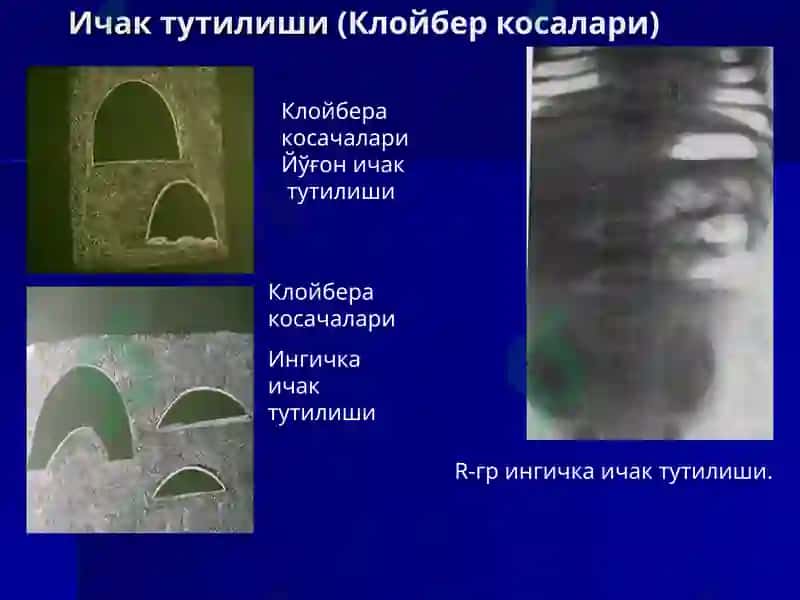 Ошқазон ичак касалликларида нур текшириш усуллари 6