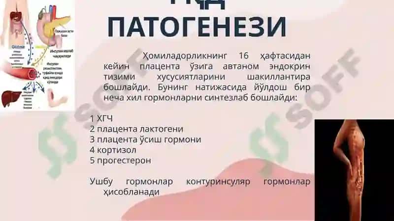 Қандли диабет 6