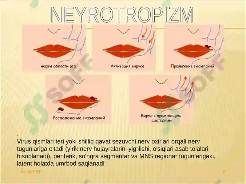 GERPETIK INFEKTSIYA 6