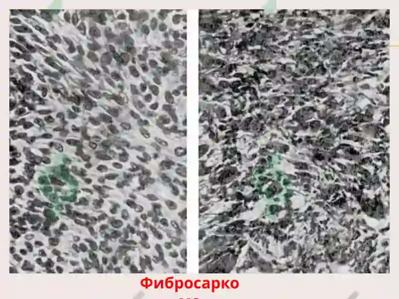 Опухоли 7