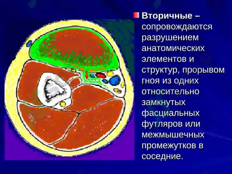 Клиническая анатомия (ОХТА) 7