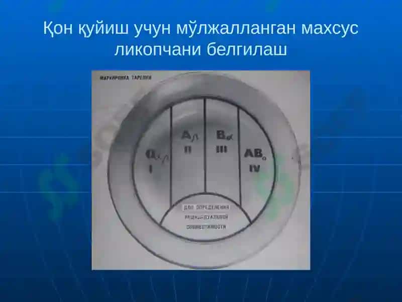 Qon quyish asoslari 7