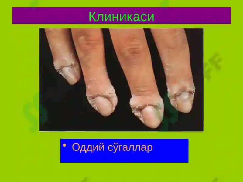 Терининг вирусли касалликлари 7