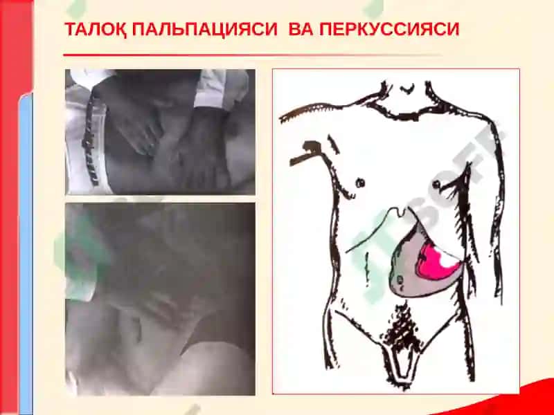 КОН ТИЗИМИ КАСАЛЛИКЛАРИ БИЛАН КАСАЛЛАНГАН БЕМОРЛАРНИ ТЕКШИРИШ. АСОСИЙ КЛИНИК СИМПТОМЛАР 7