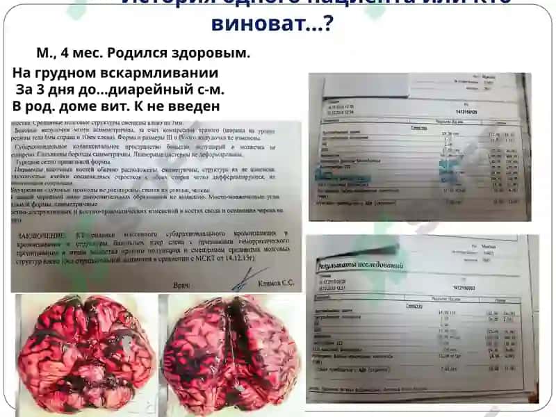 Нарушения в системе гемостаза у детей раннего возраста 7
