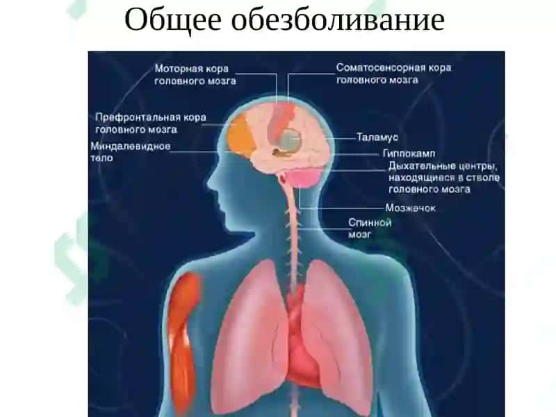 Общее обезболивание 7