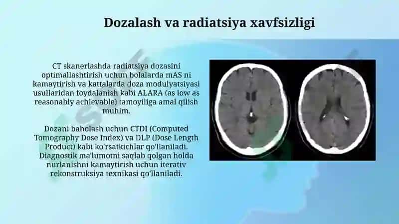 Kompyutertomografiyasi 7