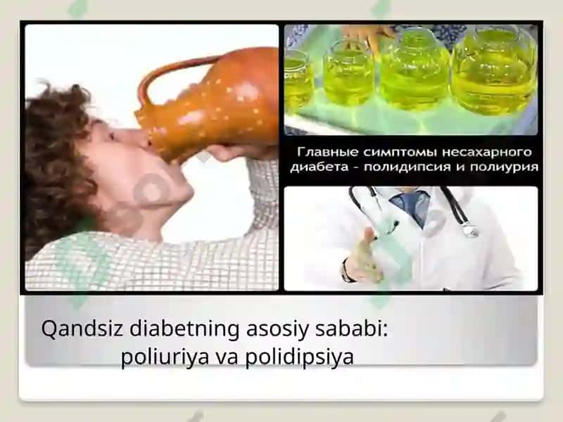Siydik biokimyosi 7