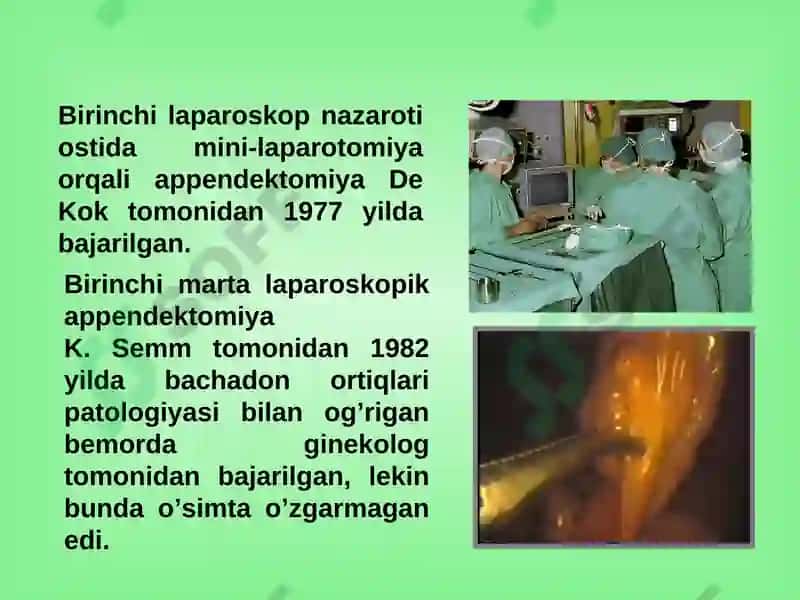 O’tkir appenditsit 7